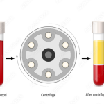 Centrifuge